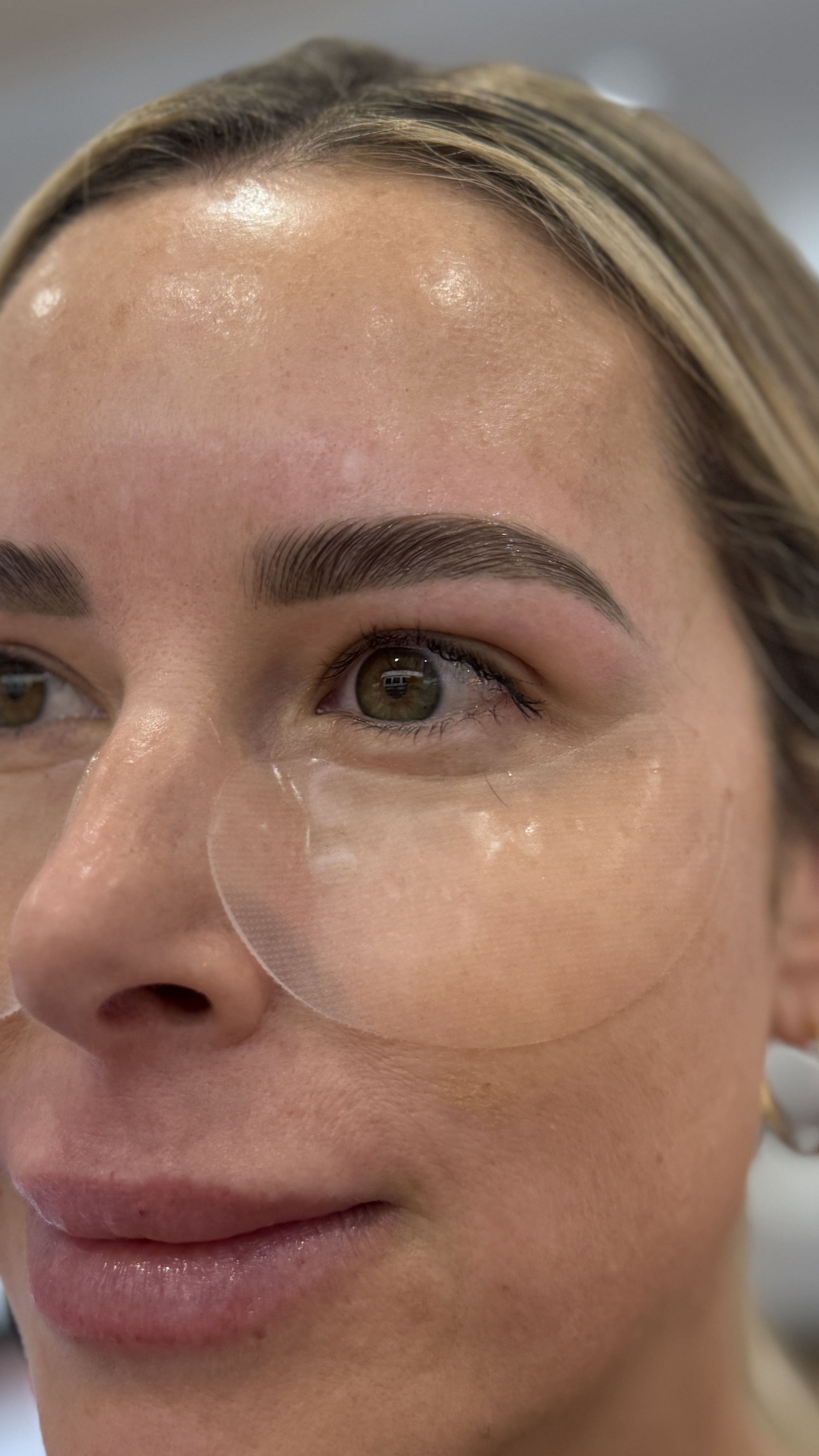 Sculpted brow result